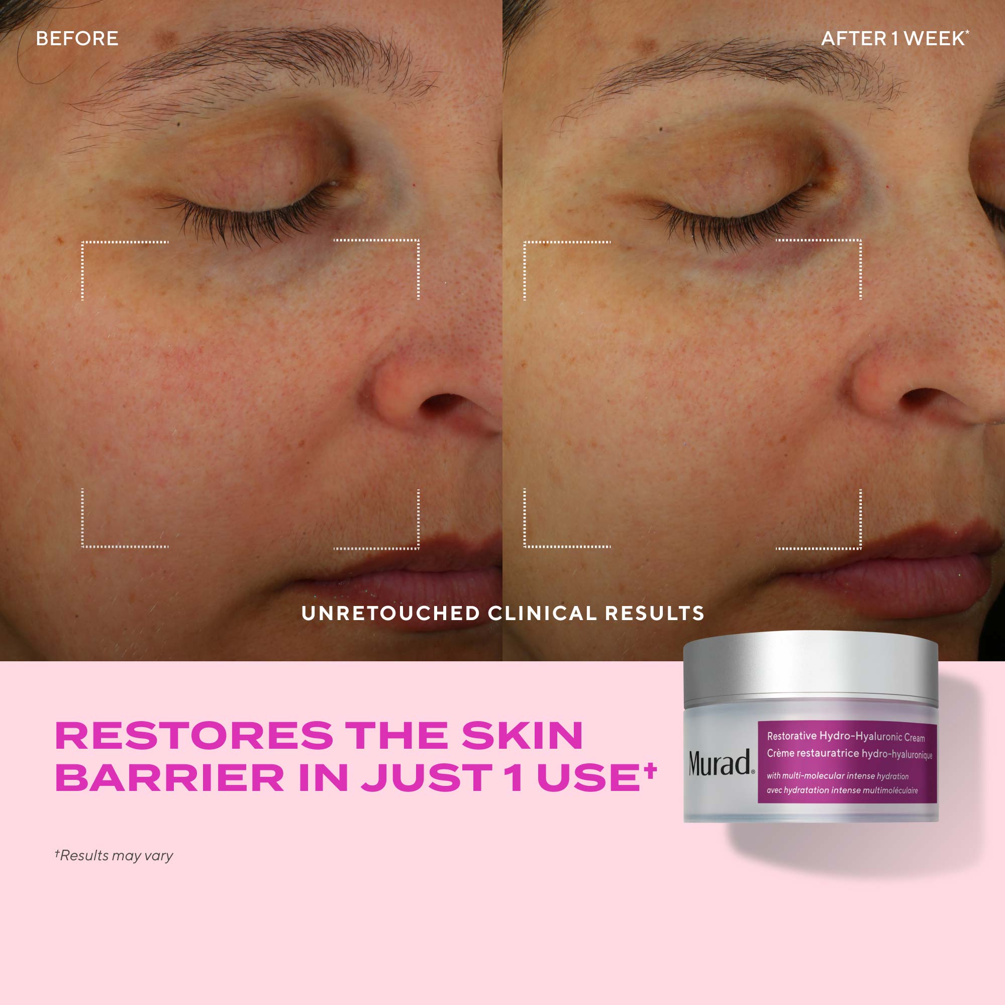 Dewy Skin Hydration Discovery Kit