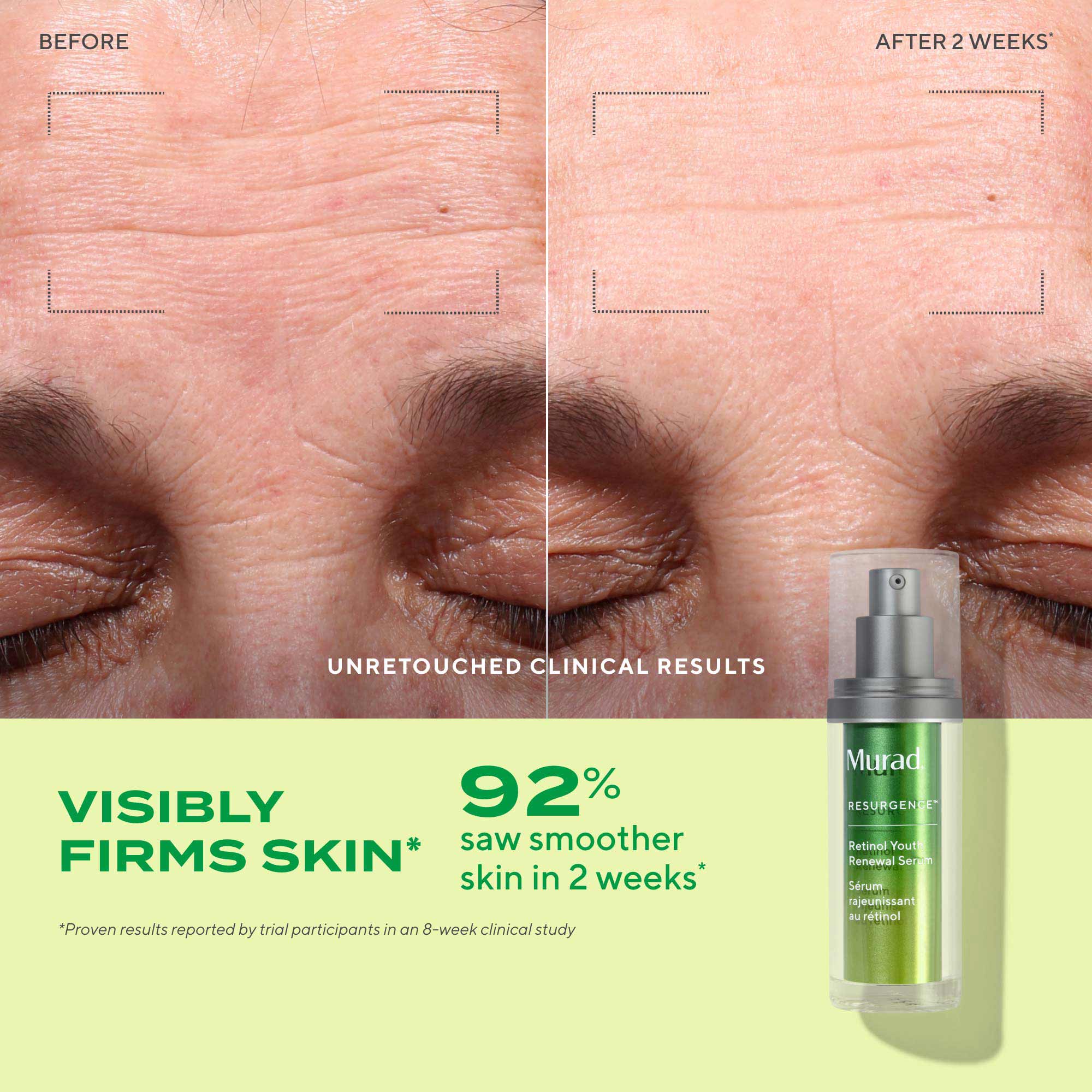 Active Renewal Regimen 90-Day Kit