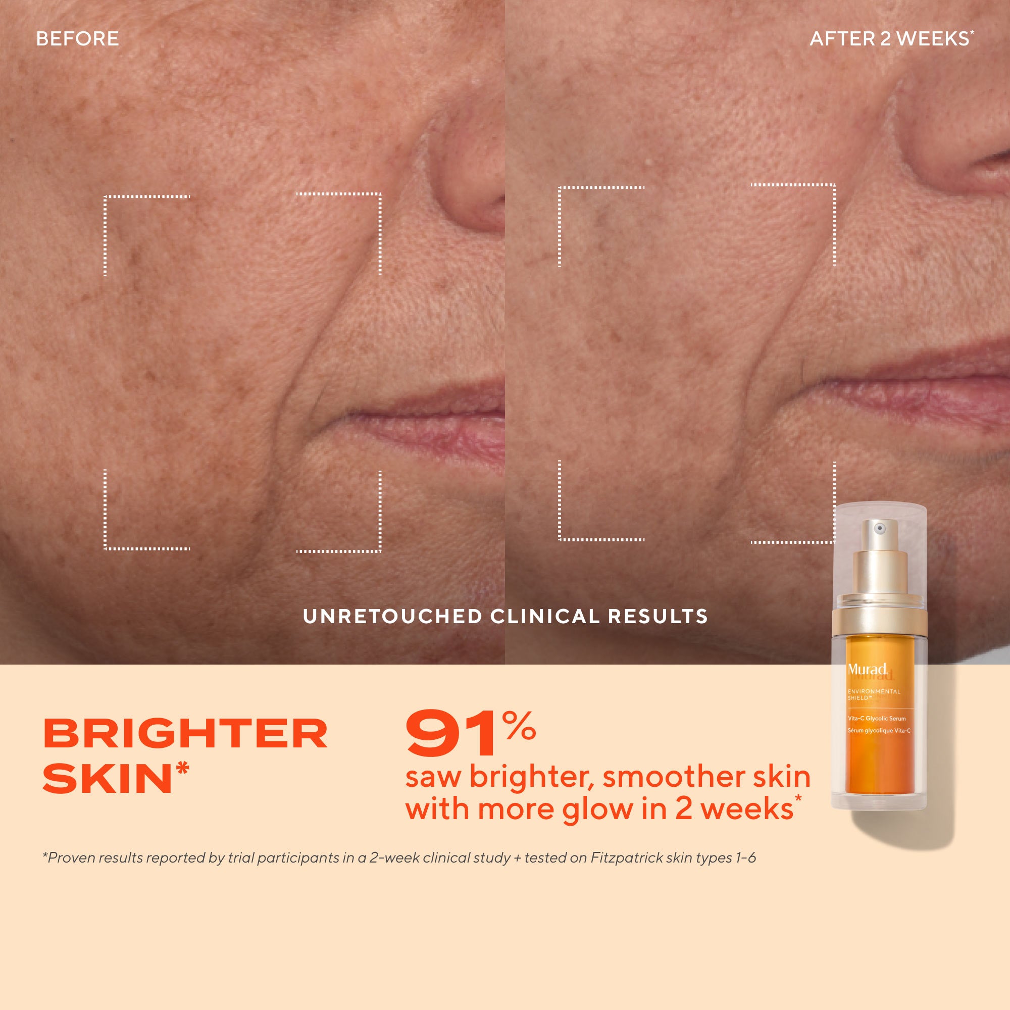 Vita-C Glycolic Serum Refill Savings Bundle