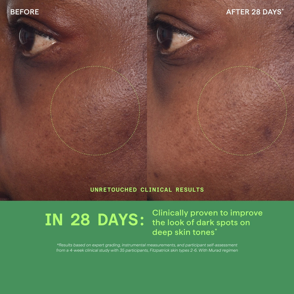 Rapid Dark Spot Correcting Serum