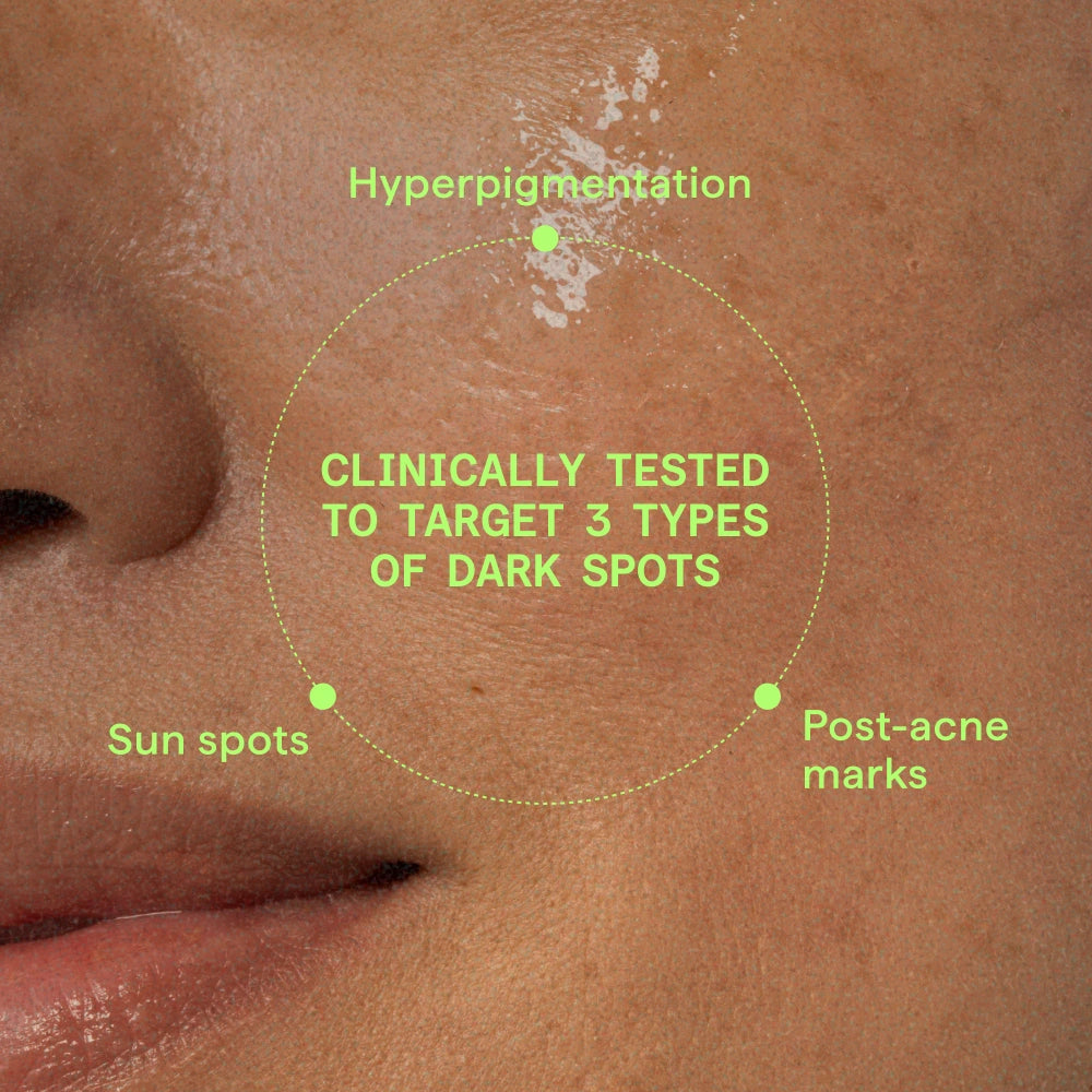 Rapid Dark Spot Correcting Serum