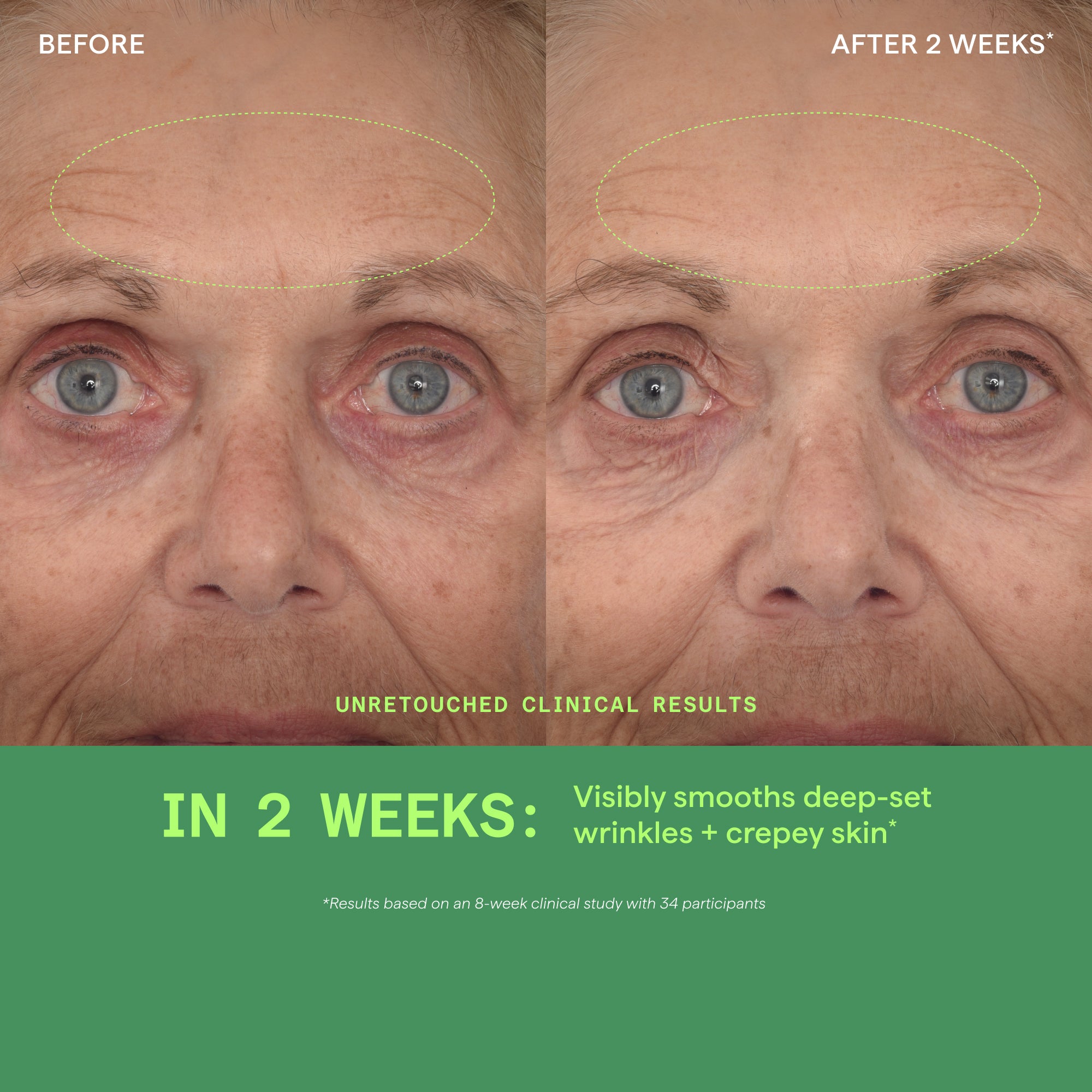 Retinal ReSculpt Face + Hand Firming Bundle