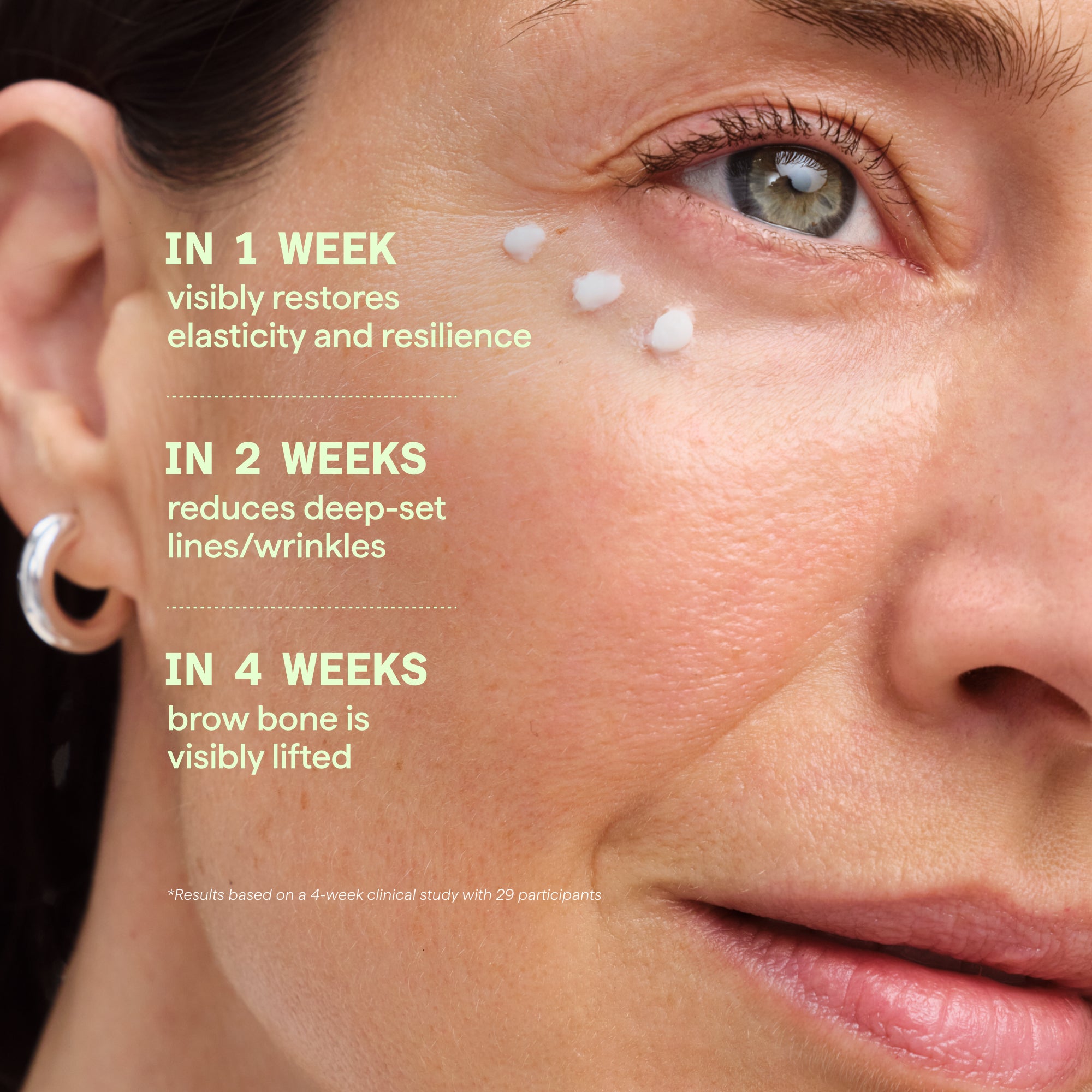 Retinal ReSculpt Eye Lift Treatment