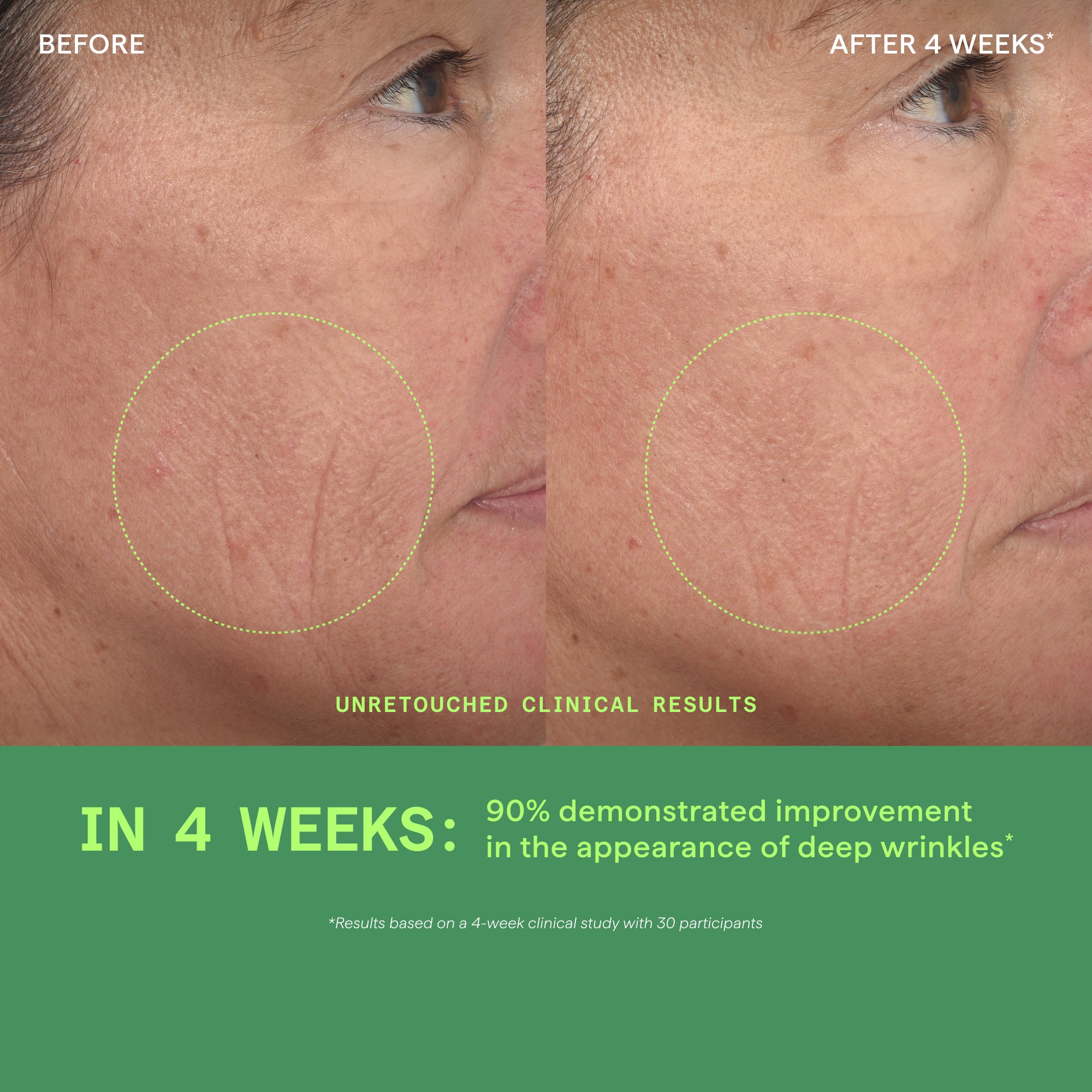 Before and after comparison of facial skin texture showing wrinkles around eye area, with results marked after 4 weeks of tre