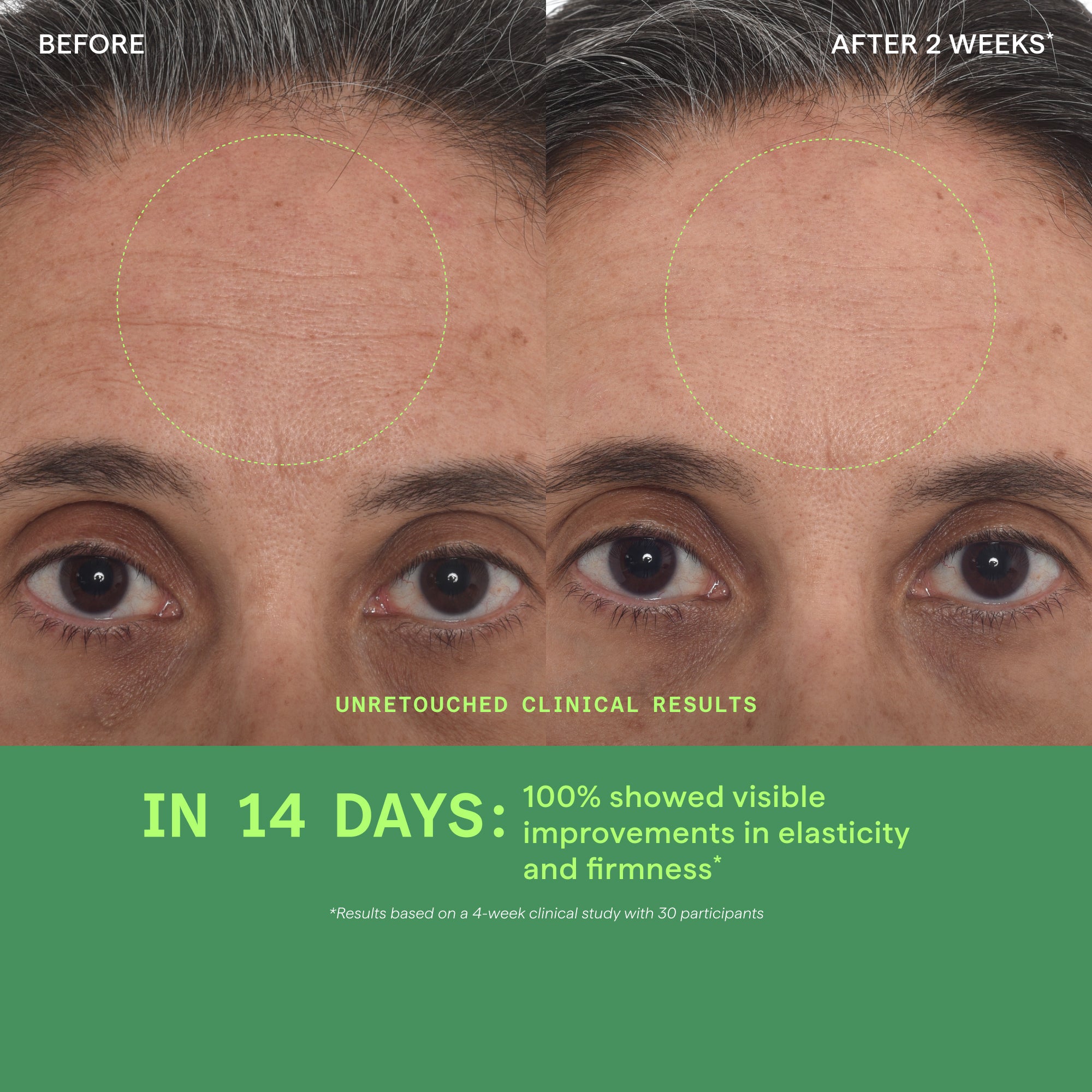 Before-and-after clinical results comparison of a woman's forehead and eyes after 2 weeks and 14 days, with a green text banner at the bottom reading 'IN 14 DAYS: 100% showed visible improvements in elasticity and firmness'.