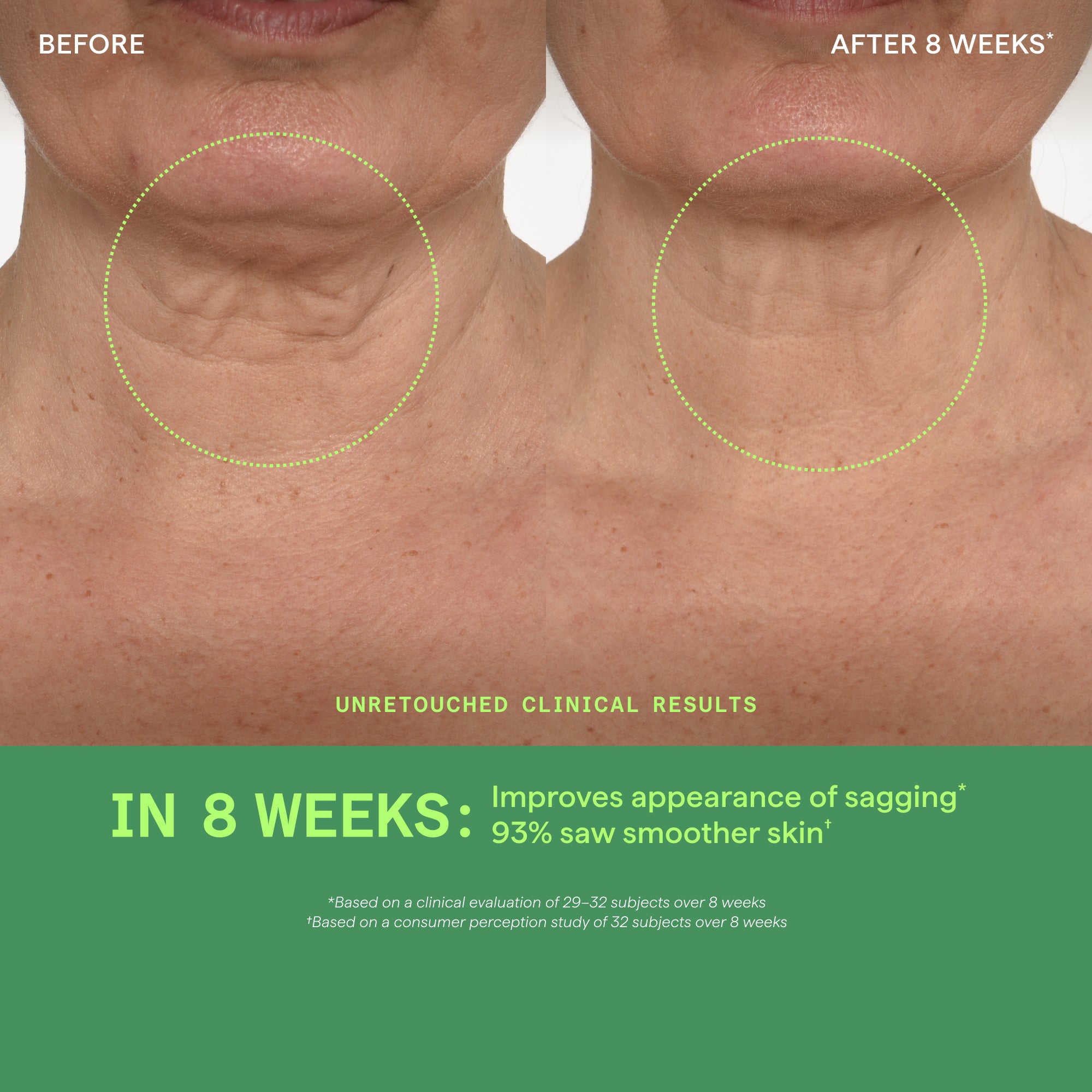 Retinal ReSculpt Neck & Décolleté Lifting Serum