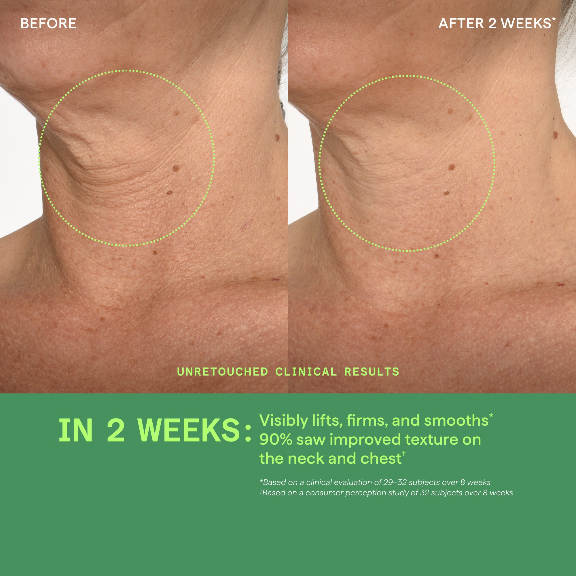 Retinal ReSculpt Neck & Décolleté Lifting Serum